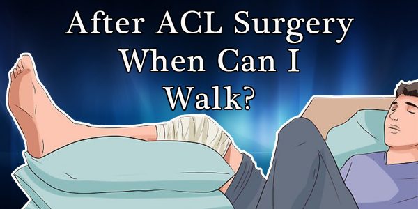 When Can I Walk After ACL Surgery?