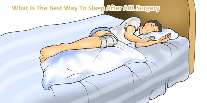 The Best Ways To Sleep After ACL Surgery?