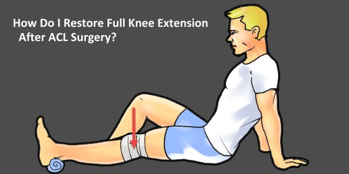 Full Knee Extension After ACL Surgery – 3 Exercises To Help You Straighten Your Knee
