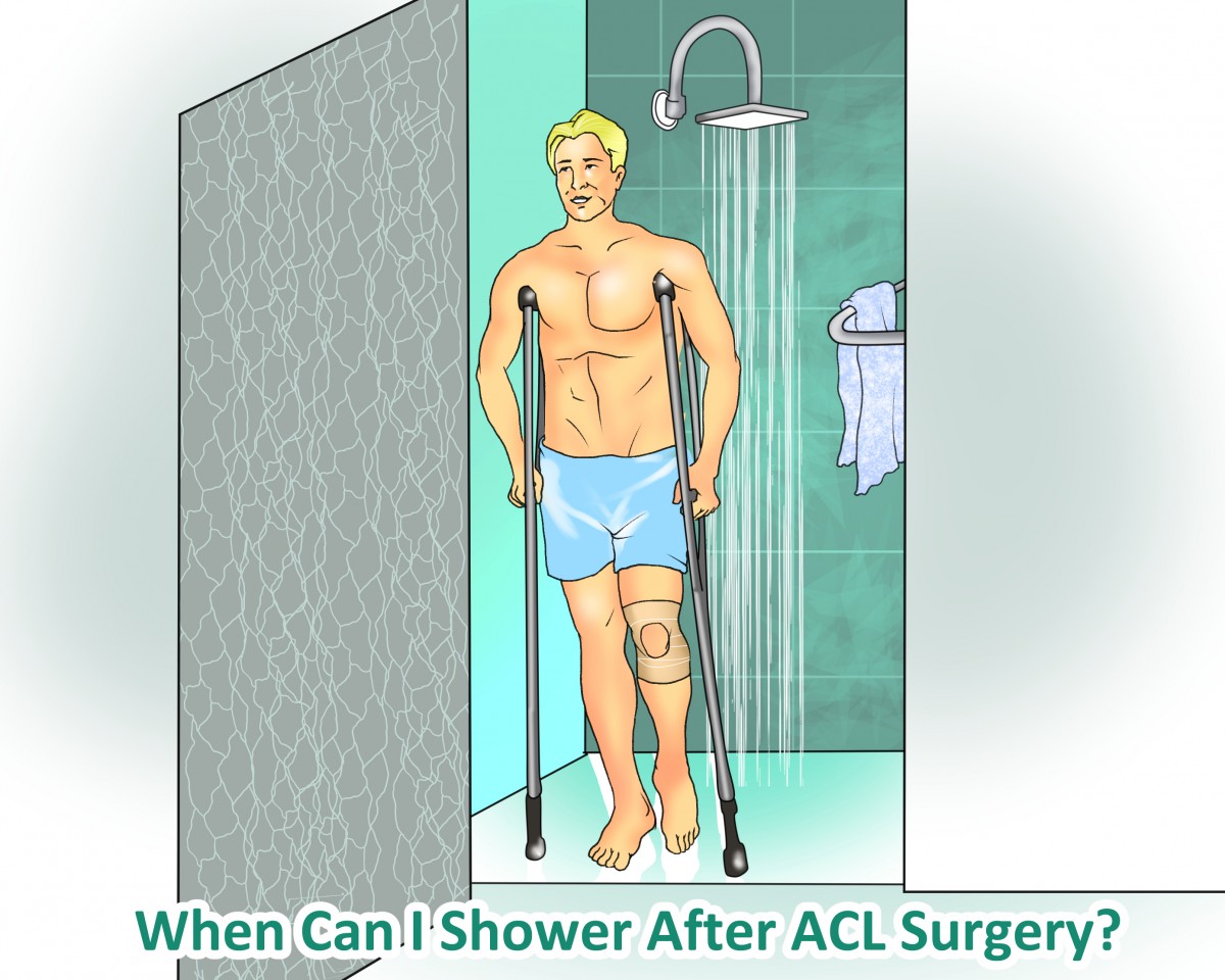 When can I shower after ACL surgery