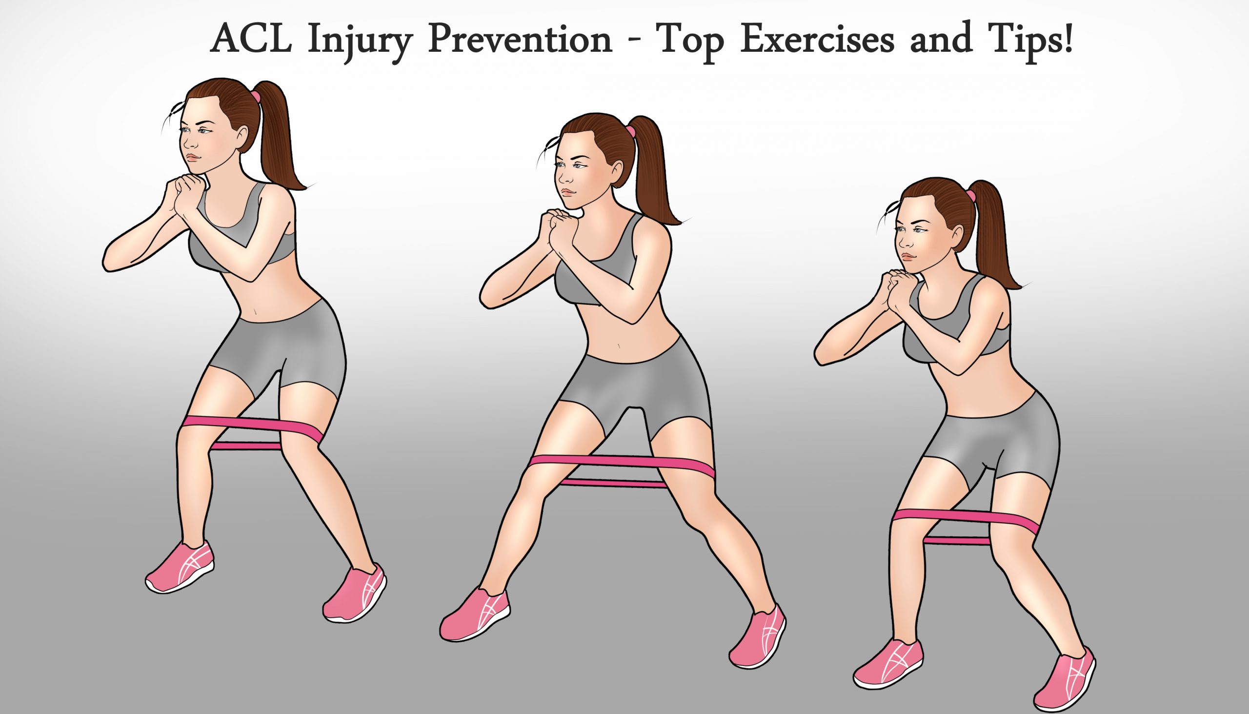 ACL Injury Prevention Exercises and Tips